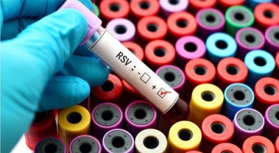 Респираторно синцитиален вирус (RSV) – опасен ли е?