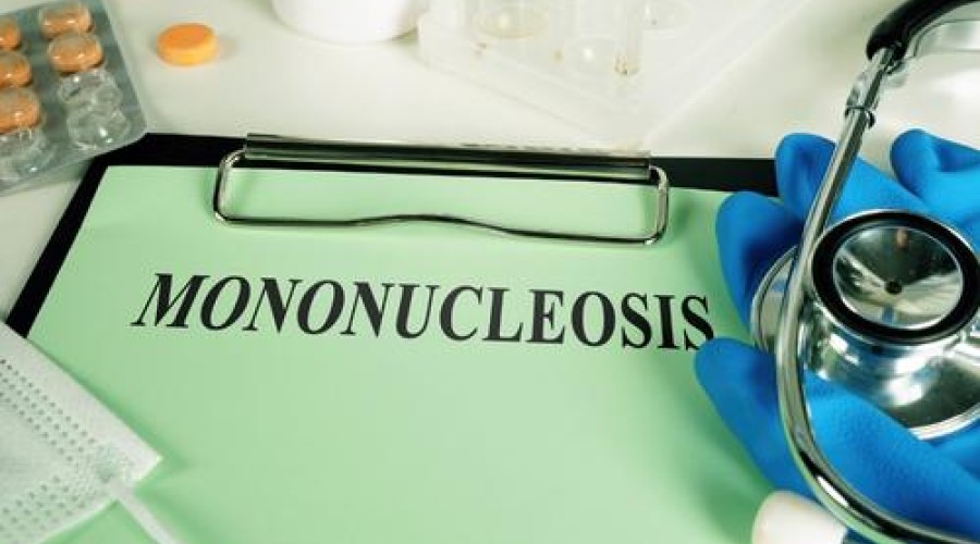 Мононуклеоза – същност, причини, симптоми, диагностика и лечение