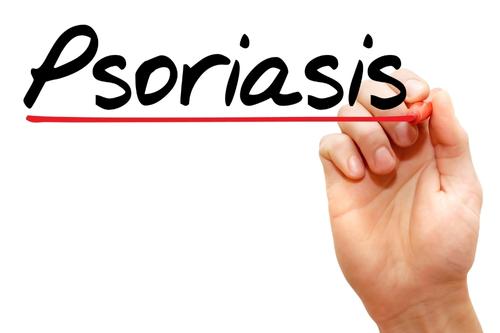 Какво представлява псориазис и как се лекуват различните видове?